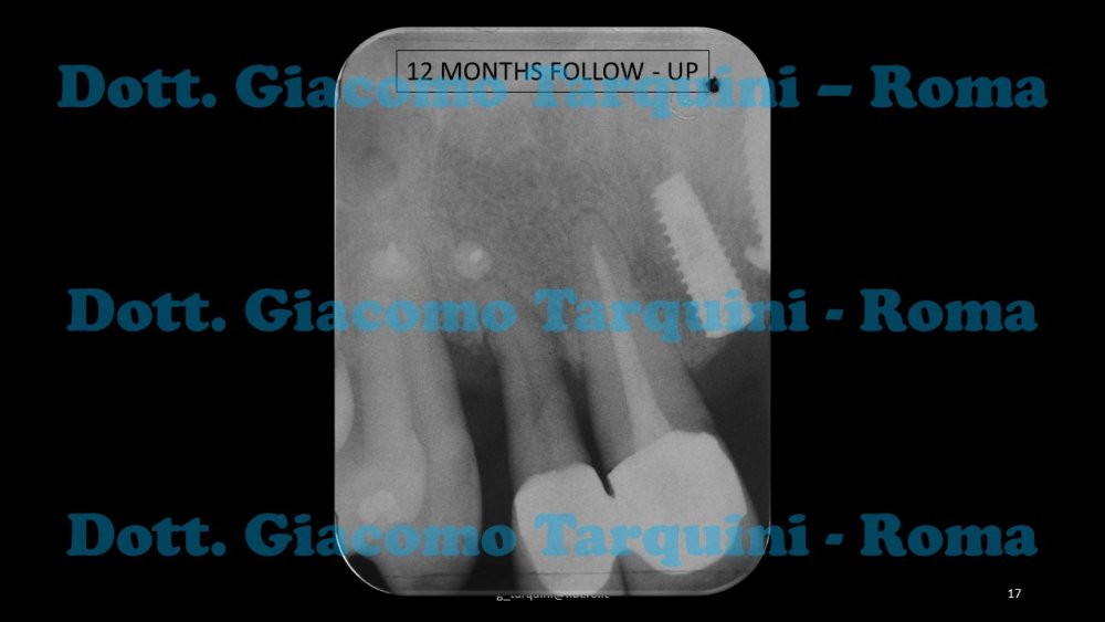 Diapositiva17.thumb.JPG.16a96b25756efa781ed6412f188344c4.JPG