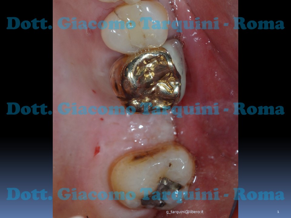 Diapositiva1.JPG.1c5ff692f8765224f43348df624556a9.JPG