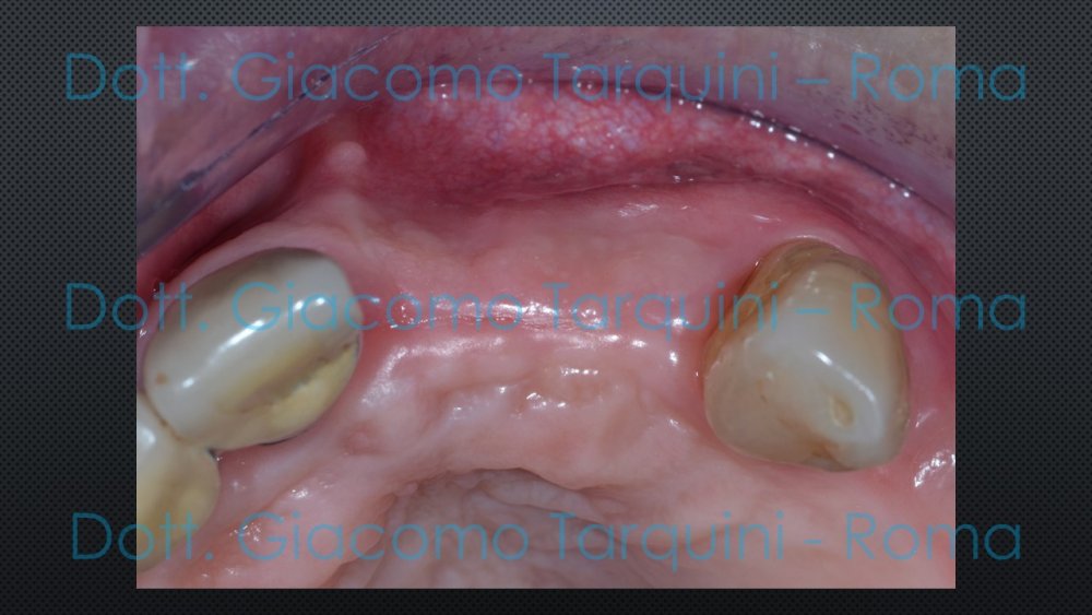 Diapositiva14.thumb.JPG.914088a05982f6d5bc6bc918bf95b6e1.JPG
