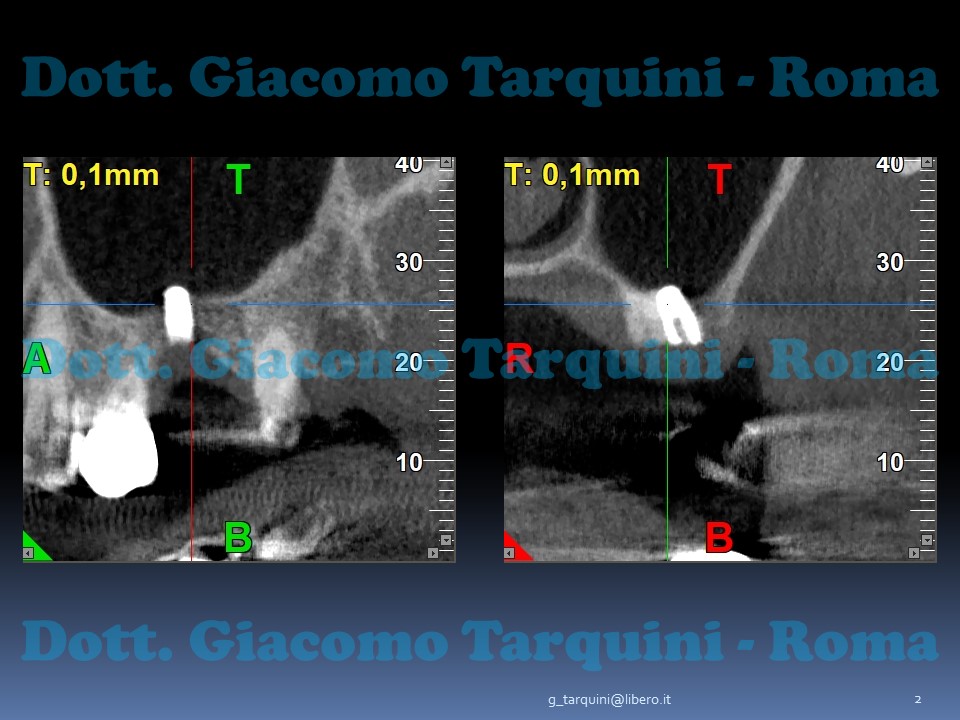 Diapositiva2.JPG.d278add41423fa39387cd00425314010.JPG