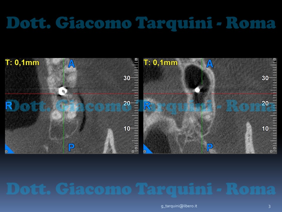 Diapositiva3.JPG.58944ed5d57ccaa57b46d01f384c71f7.JPG