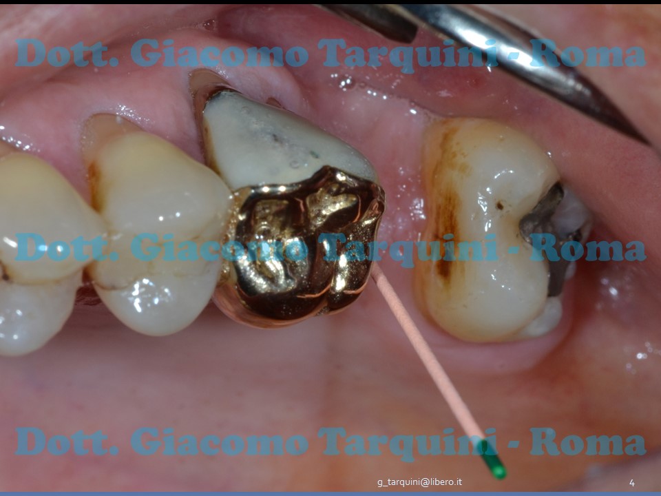 Diapositiva4.JPG.4caa0dabae216786de50b60c22e558a6.JPG