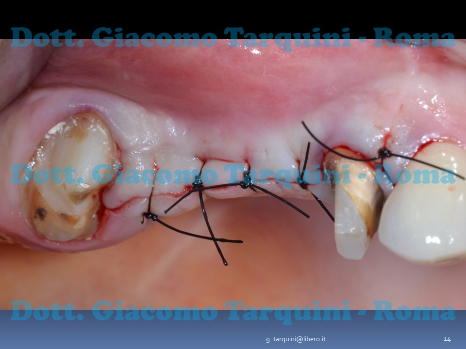 Diapositiva14.JPG.09ced02b2218cdc7fe86134020e25fce.JPG