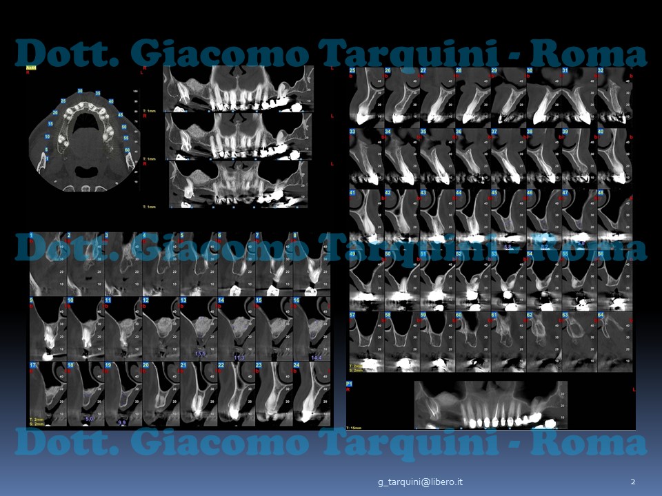 Diapositiva2.JPG.21dc40d3901992ef3153df47dabbf8e6.JPG