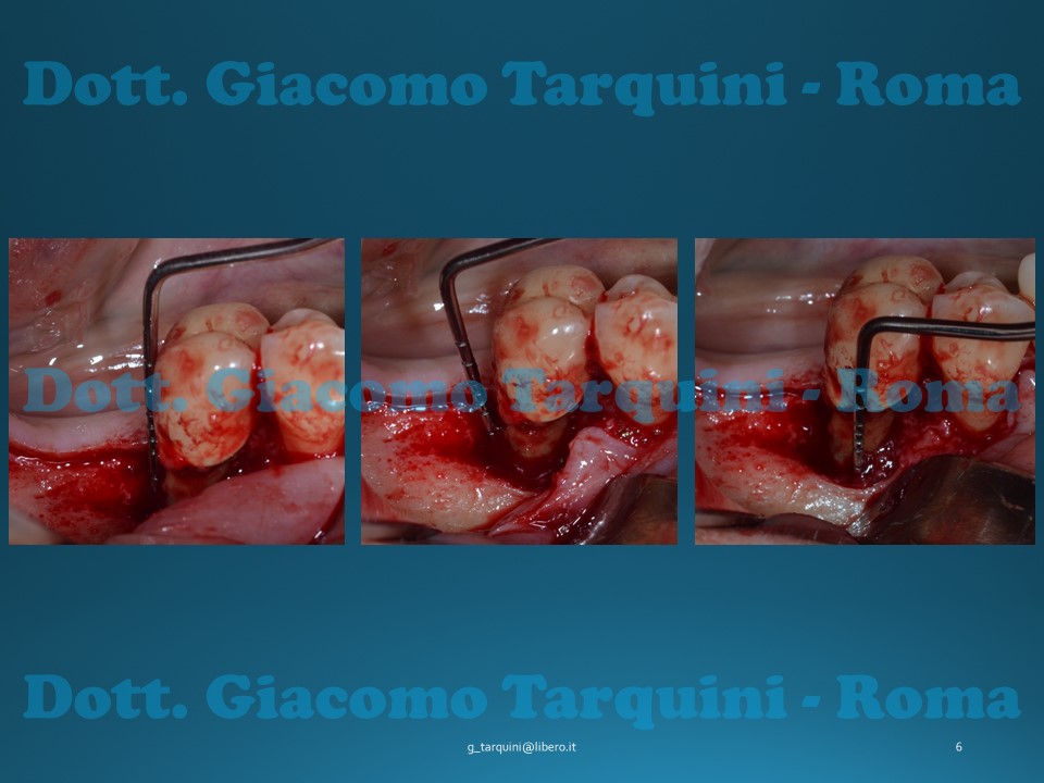 Diapositiva6.JPG.3539924faabad5d478e691aa9695993d.JPG