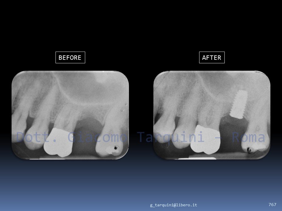 SINUS_PIEZO.jpg.f9655553a3a14f839a096d4595006a2c.jpg