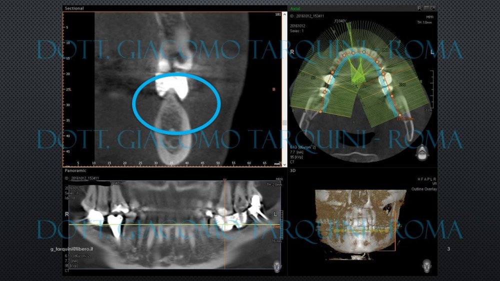 Diapositiva3.thumb.JPG.3920d22a25cf1db20179bebfb301344d.JPG