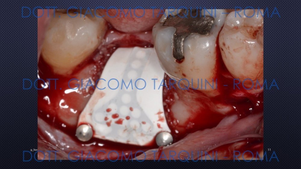 Diapositiva11.thumb.JPG.242d3bee235529d3e24cf817c4ba7105.JPG