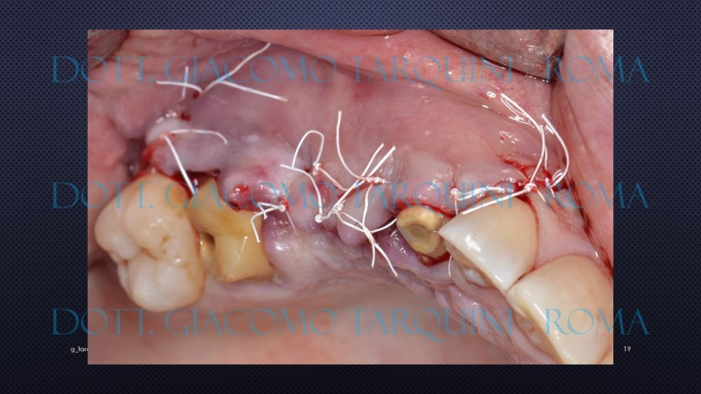 Diapositiva19.thumb.JPG.e5a6fca95d21d8102643f012a8b0cd05.JPG