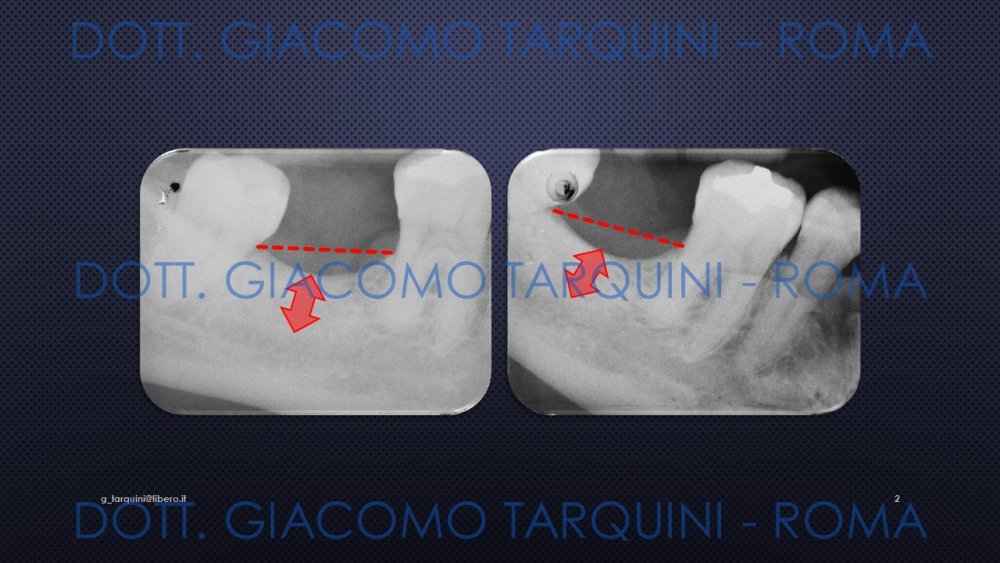 Diapositiva2.thumb.JPG.a67af48e8ed0ad040bdedc8e098bdf5d.JPG