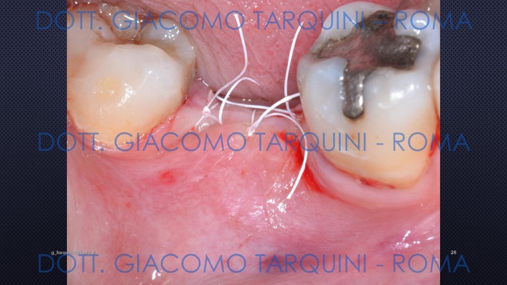 Diapositiva28.thumb.JPG.aa211d09cded4526cdc072ed962e050c.JPG