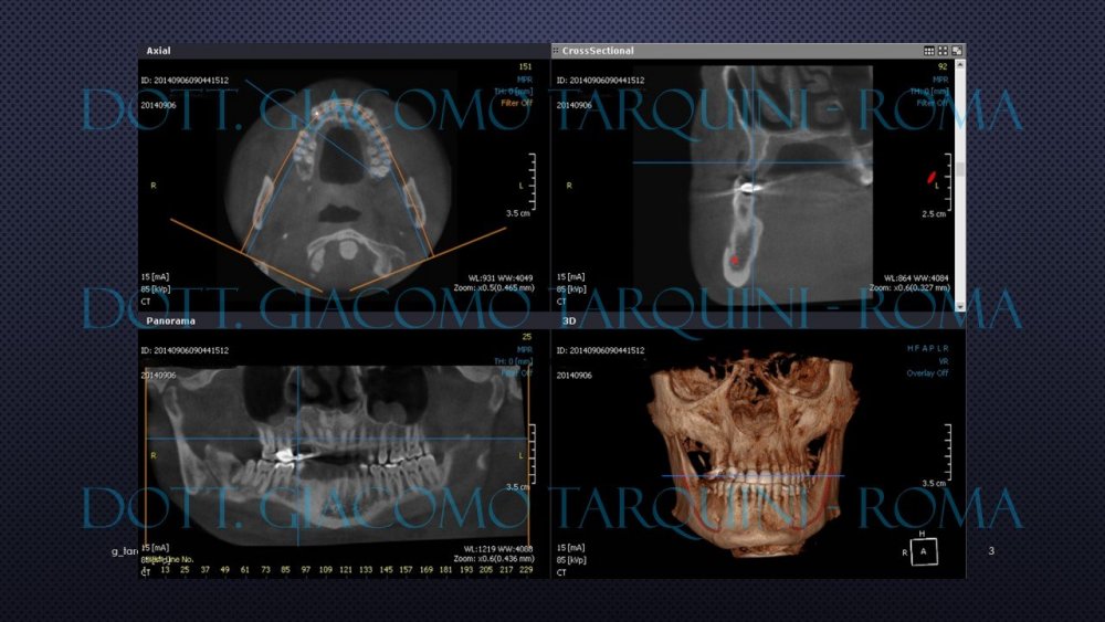 Diapositiva3.thumb.JPG.5955c674df29ac23ab40adf06ac33ccc.JPG