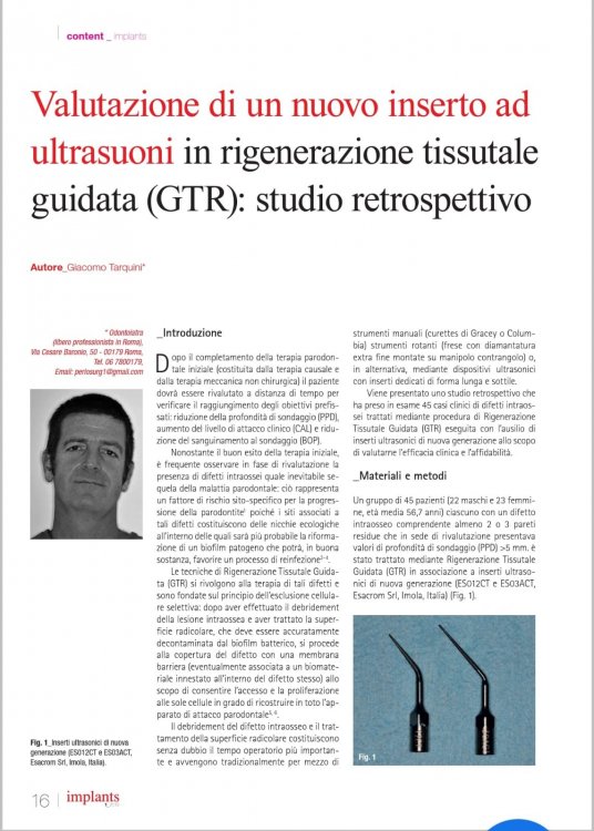 266494914_TarquiniImplantsItaly.thumb.jpg.736567a7abe5453bcebed50ac682a839.jpg