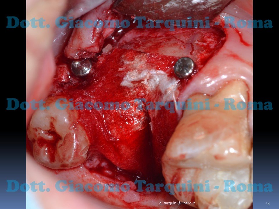 Diapositiva13.JPG.7e719ec135ed86db8595abe5ede3b7b3.JPG