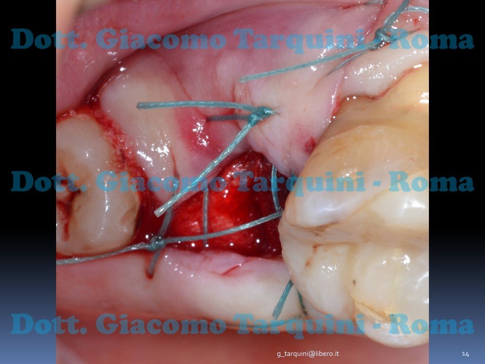 Diapositiva14.JPG.546291c08bd3c5b8e218e36ec2434ff5.JPG