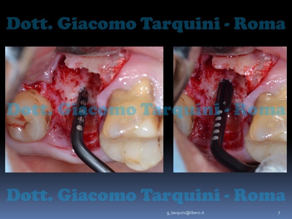 Diapositiva7.JPG.9a9e661f5c5fe109d26a49ea1c006778.JPG