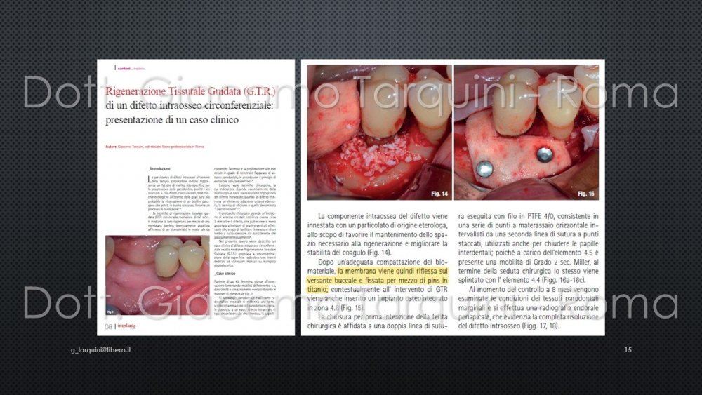 Diapositiva15.thumb.JPG.8f74419b1215fba841e60b35904211e9.JPG