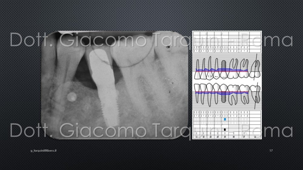 Diapositiva17.thumb.JPG.78d404f8dd8ea1965b8a95b246f636d4.JPG