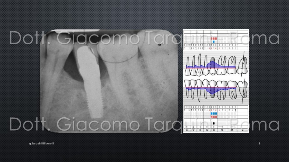 Diapositiva2.thumb.JPG.eb59e3029db3f3c0b8148592a40e061f.JPG