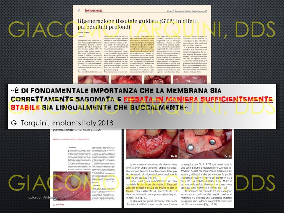 Diapositiva17.JPG.01872a3085af85d027232518df1f14af.JPG