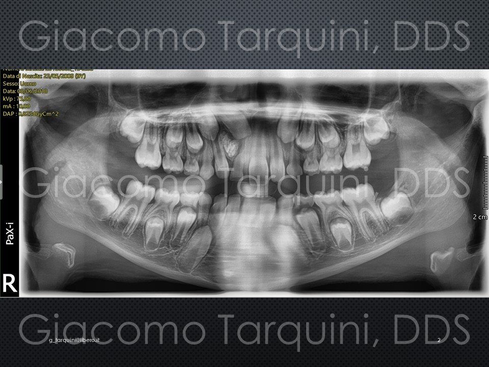 Diapositiva2.JPG.cf4d84e02a3f8890591b27911575652c.JPG