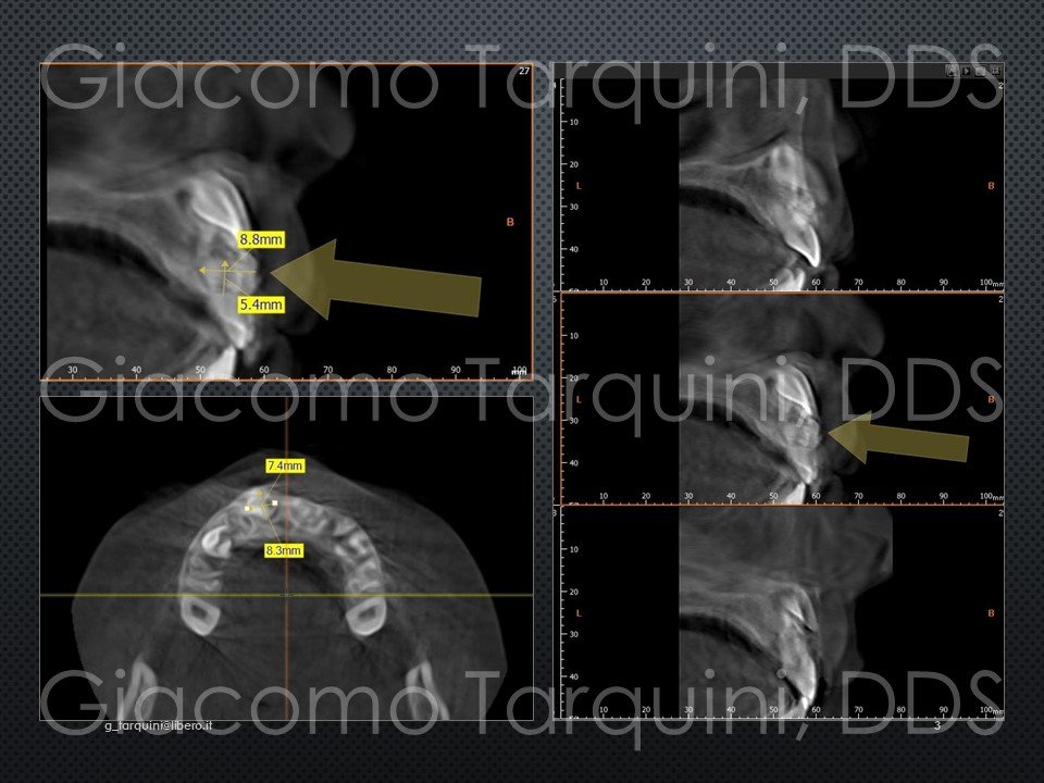 Diapositiva3.JPG.ea962c2d16f35eacc74da3b9571a57a1.JPG