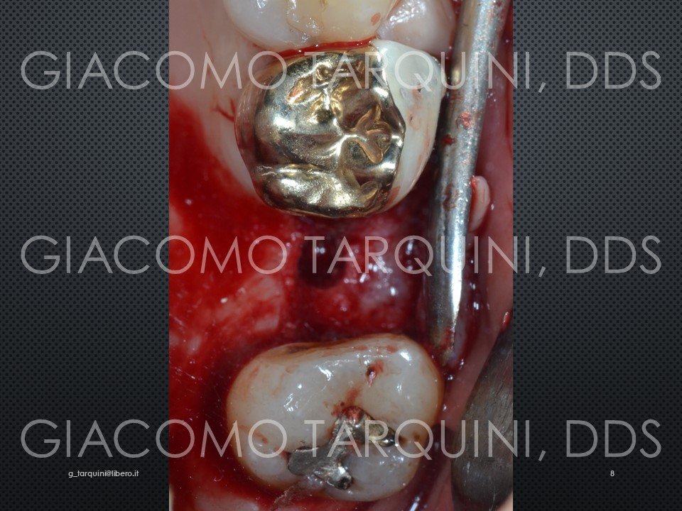 Diapositiva8.JPG.9978b9d6c486a5adc740531d65a70f58.JPG