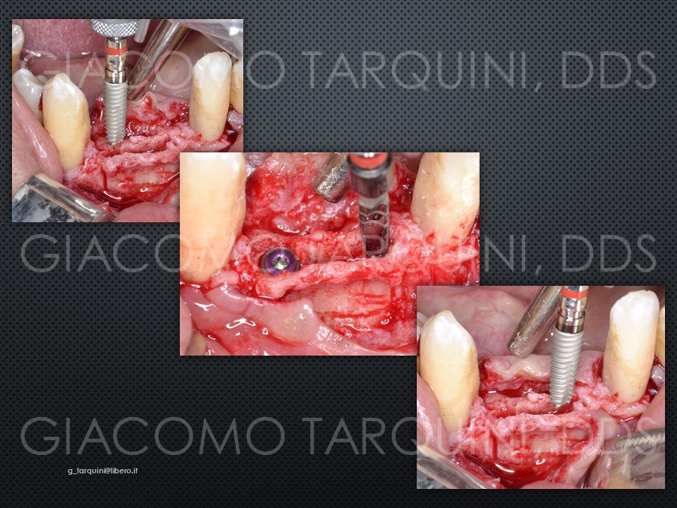 Diapositiva16.JPG.875b4a6781e49867a44d17ddc505e614.JPG