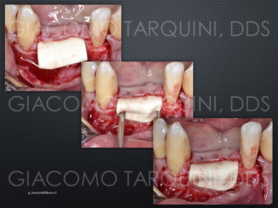 Diapositiva18.JPG.3d534ba60032c40b5e253d95b04413a2.JPG