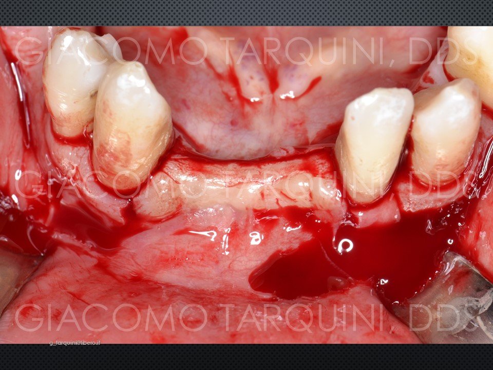Diapositiva26.JPG.00bc356be162ec0187b372ff6a356f69.JPG