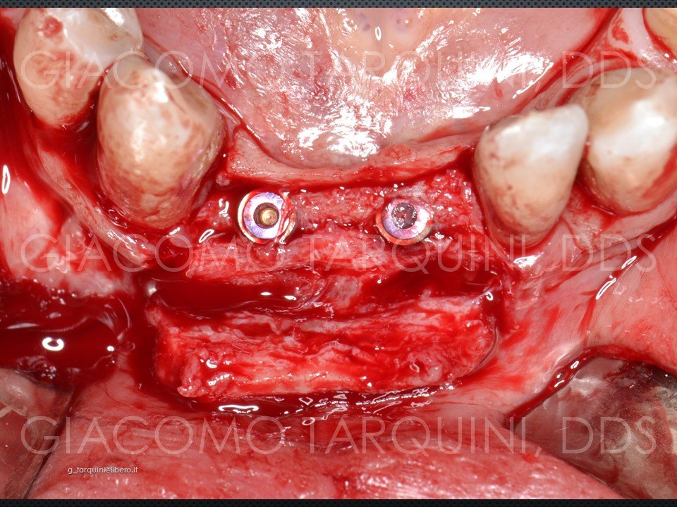 Diapositiva27.JPG.6c15db41b862fbc78c3ffeef6ab94b6e.JPG