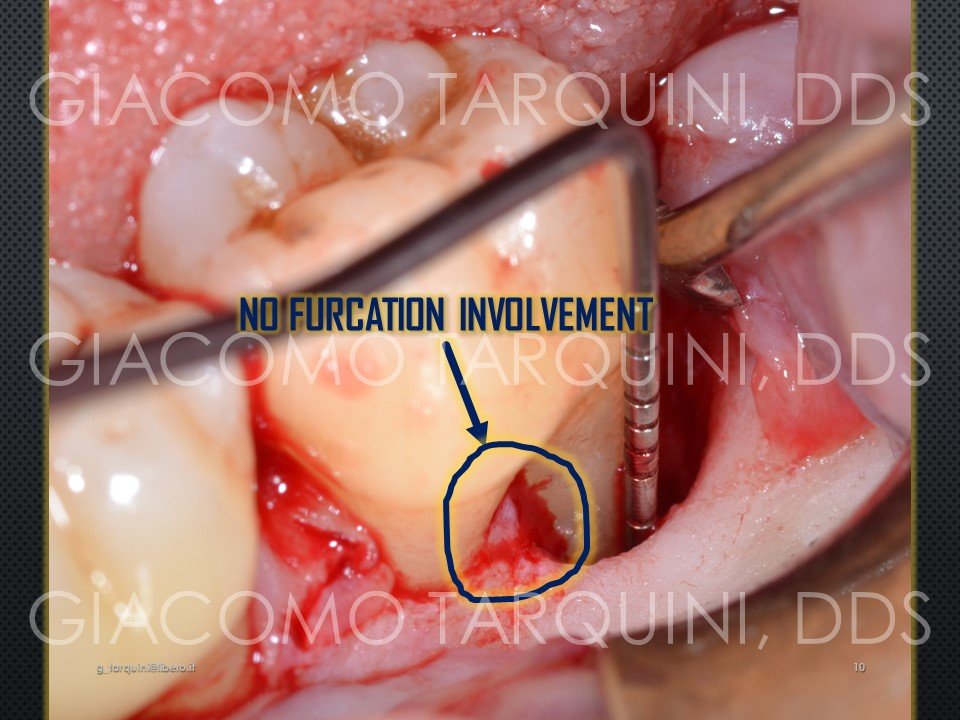 Diapositiva10.JPG.4fa9d77c6cd86609baf2bcffe47f80a7.JPG