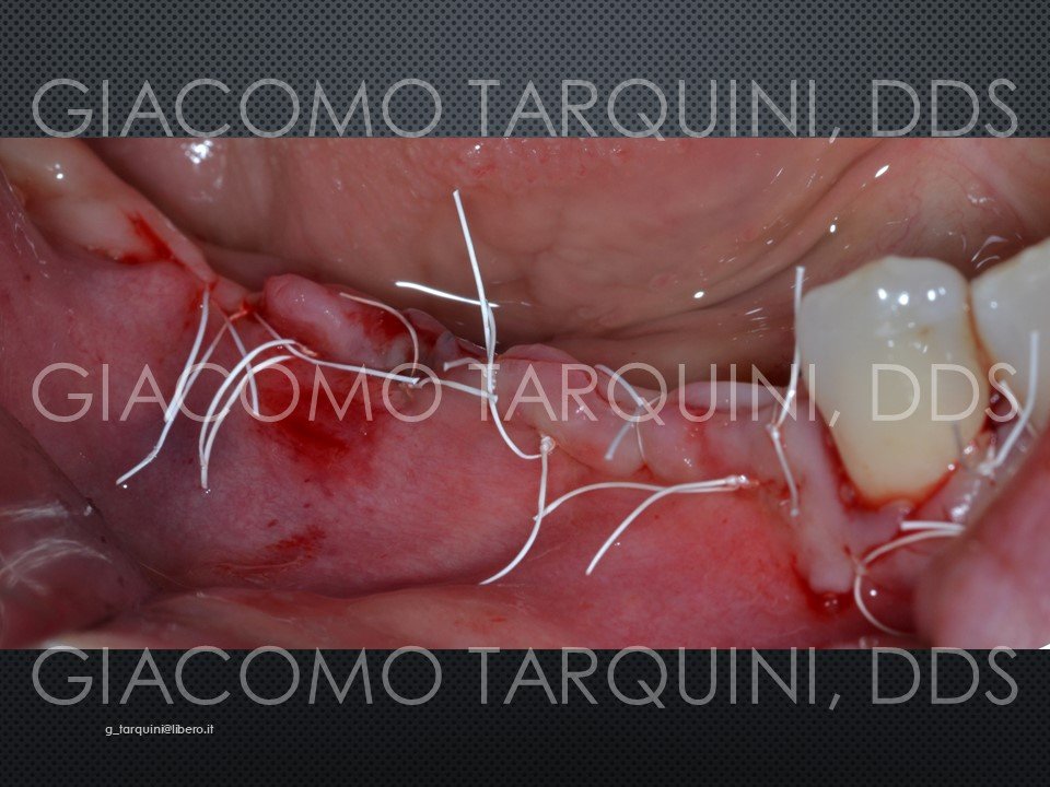 Diapositiva15.JPG.212f1cc860e939dc1721e49c0f4b23d1.JPG