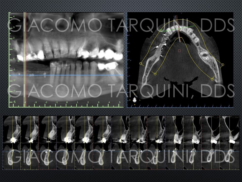 Diapositiva19.JPG.0fcdd81bdf30976adbec2e88c9ee07b2.JPG