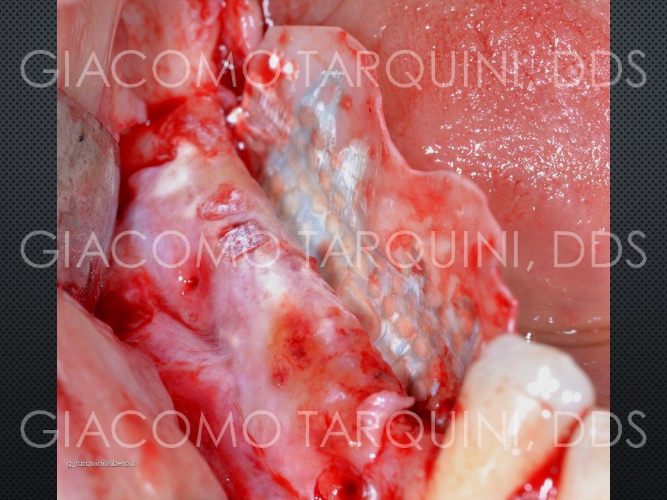 Diapositiva22.JPG.65603b6b48b685028f0892b8cf49d978.JPG