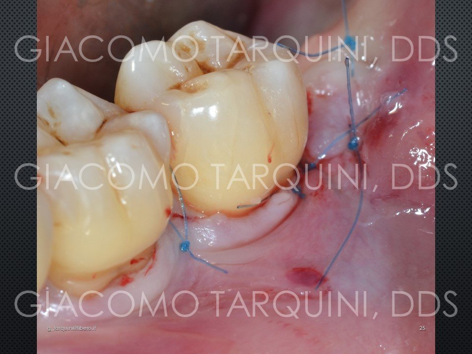 Diapositiva25.JPG.a2950fd45286114e7f448c76454e6077.JPG