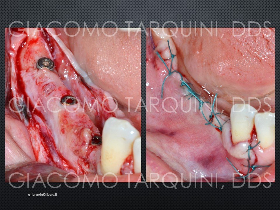 Diapositiva30.JPG.ec2acb02d05cbec7f77ea3ae904af28d.JPG