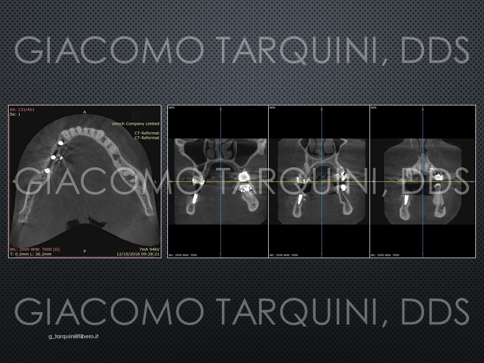 Diapositiva31.JPG.9120c5b017103c4903ca9537de94d922.JPG