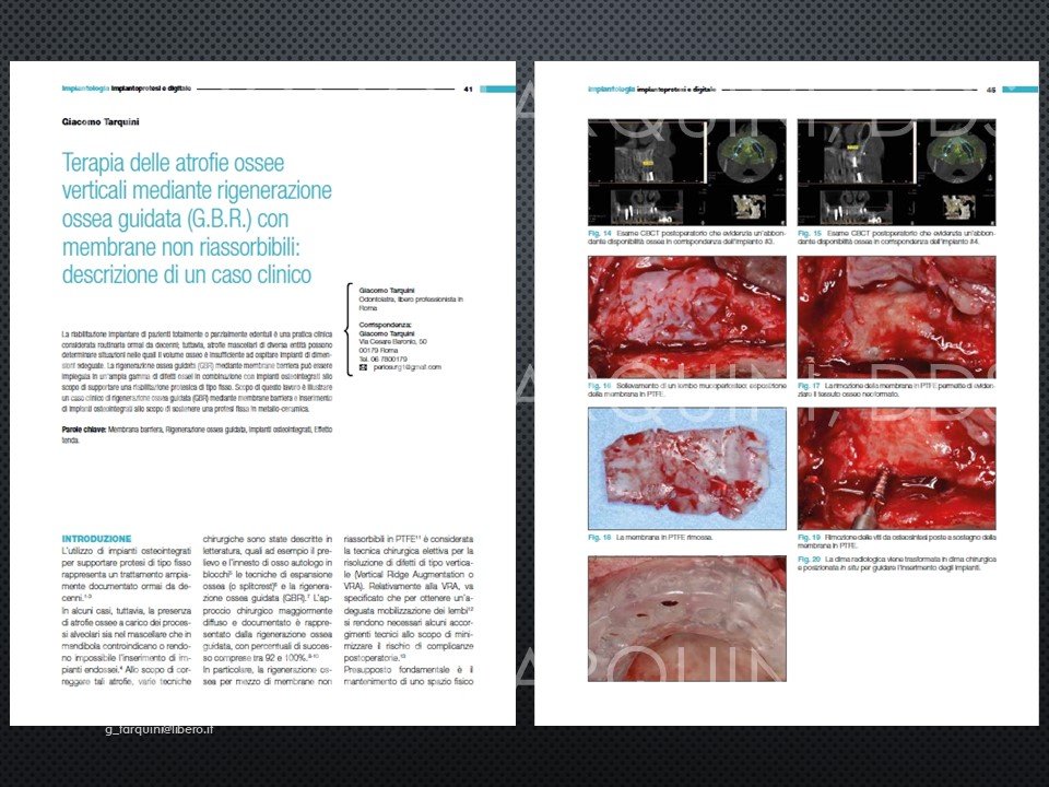 Diapositiva32.JPG.741d443f29245c5e3346cdf3a46f038d.JPG