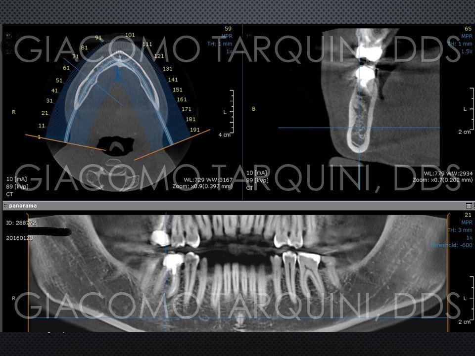 Diapositiva3.JPG.a4bf24904f9f0073800a44c89988b4b0.JPG