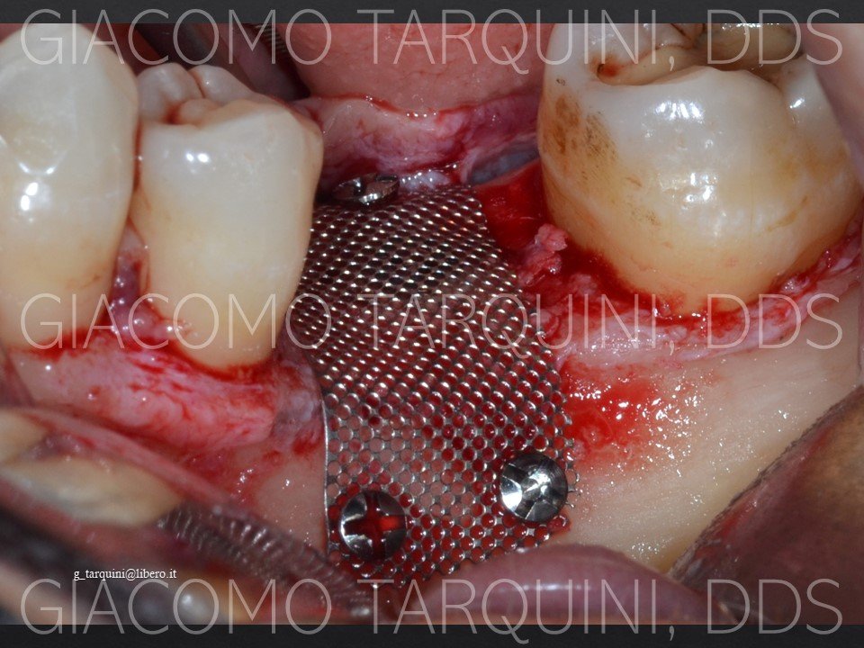 Diapositiva17.JPG.b7cb786d77ce3c757e4bb69c63fed98d.JPG