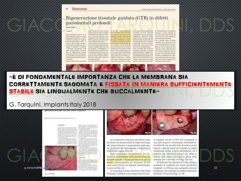 Diapositiva22.JPG.eb7a7788f73d22f918d9688f780d934e.JPG