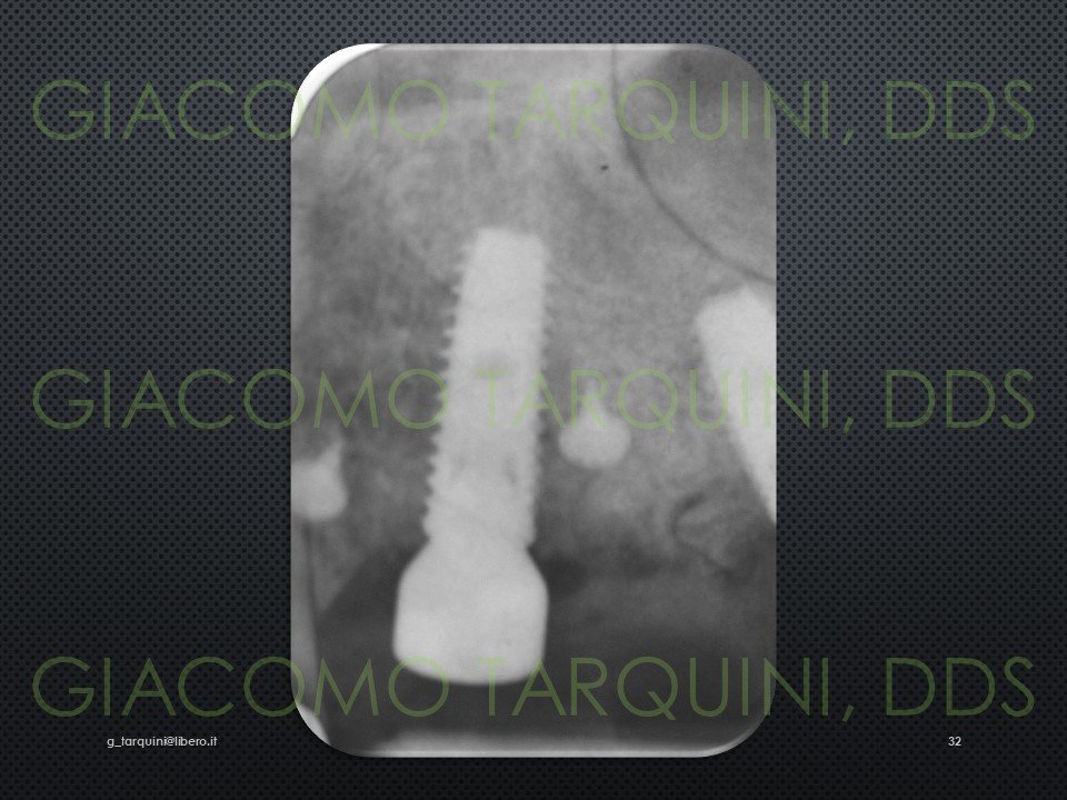 Diapositiva32.JPG.0c17d74bb1fe8621d64c4bc2a74c5741.JPG