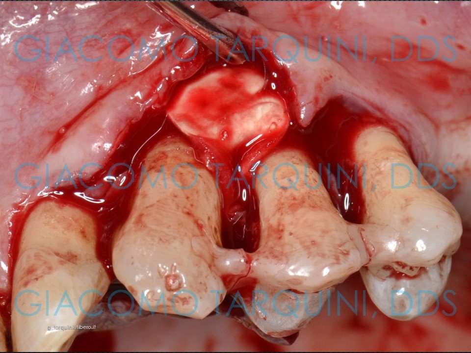 Diapositiva15.JPG.412ef44eae8e4b72ba44894d6d0efceb.JPG