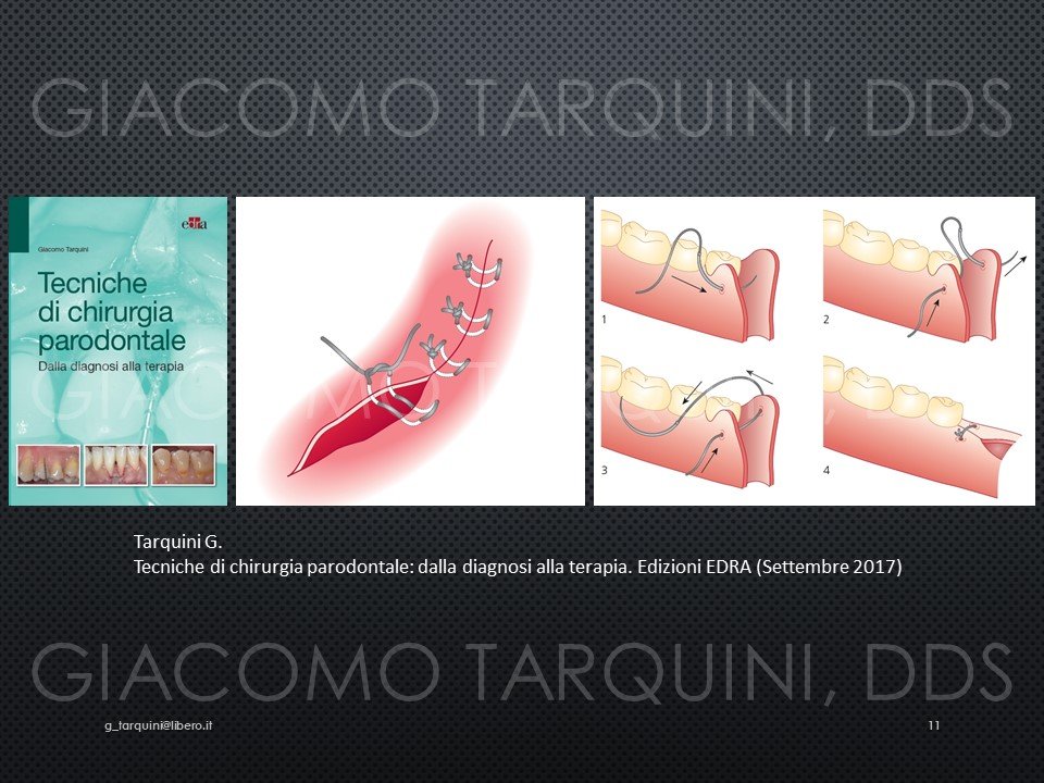 Diapositiva11.JPG.1b5bbd488c2ede096664465e2e44e81b.JPG