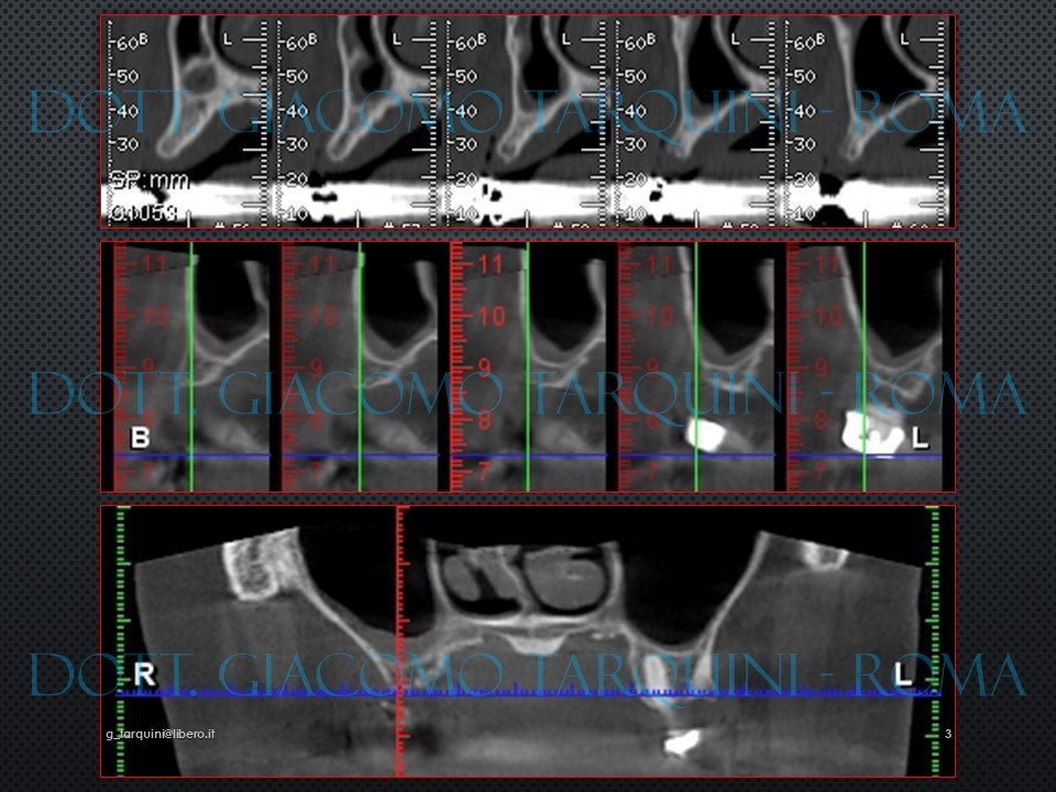 Diapositiva3.JPG.94306a609cb4eb6429d4975eb5fab34e.JPG
