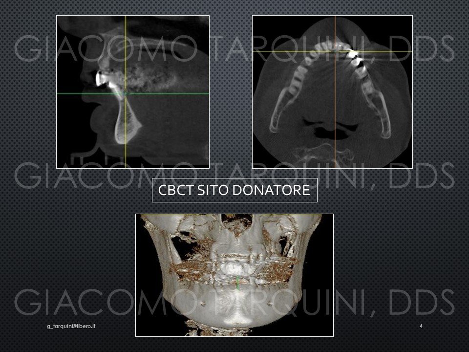 Diapositiva4.JPG.ac5cfc3166367c7747dd95e31a6cfe4f.JPG