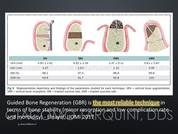 GBRMANDIBLE2_55324.jpg.a490f9fa070a8d392d68b70ba8d4c1d2.jpg