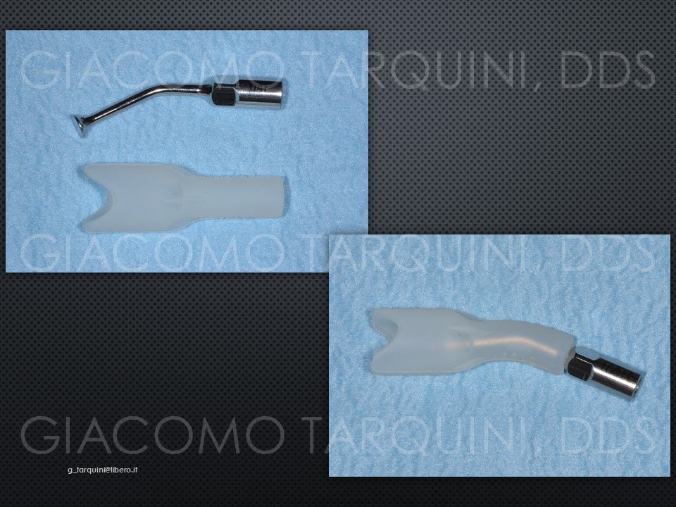 Diapositiva14.JPG.5536bc50d7811036e8fd1b91c5bbd000.JPG