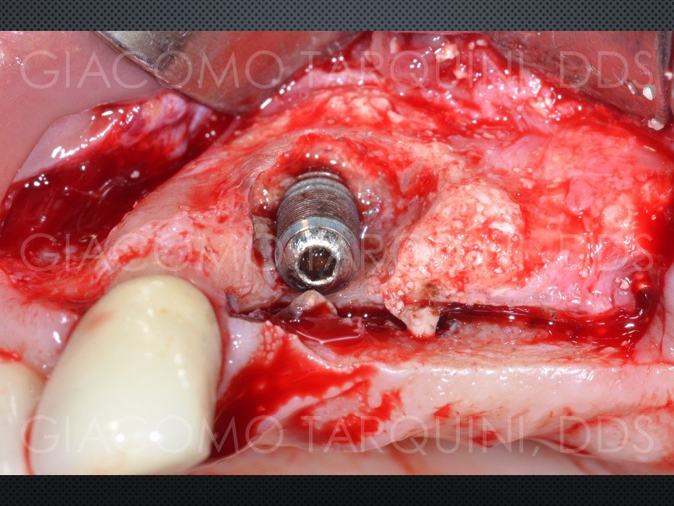 Diapositiva17.JPG.91f5138504e5a1be5e465513096db891.JPG